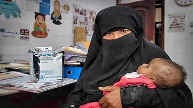 حرمان 242 ألف طفل وامرأة في اليمن من علاج سوء التغذية الحاد